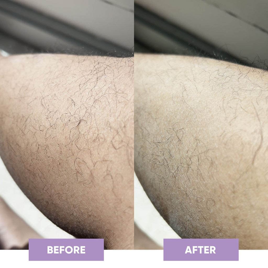 PuraPulse conversion PDP before after square image