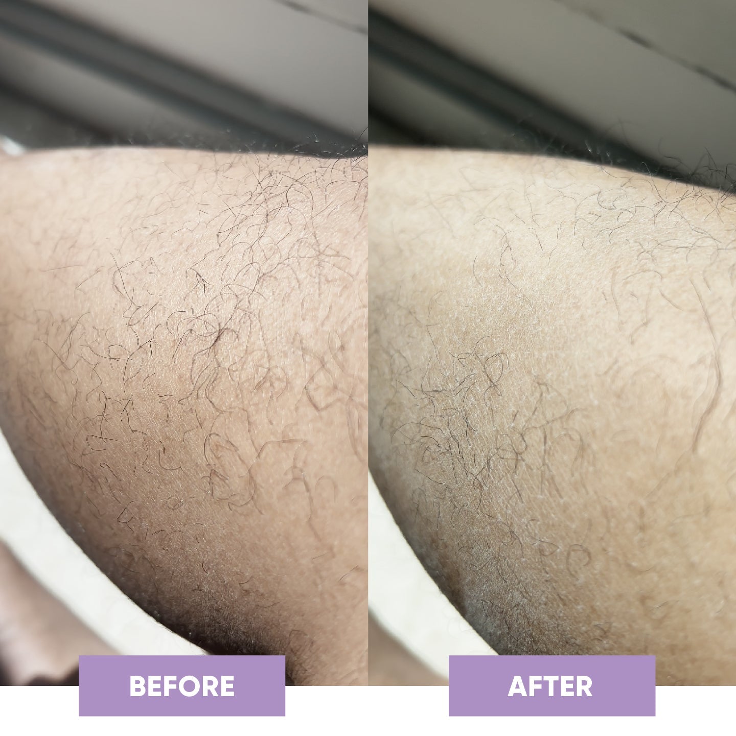 PuraPulse conversion PDP before after square image