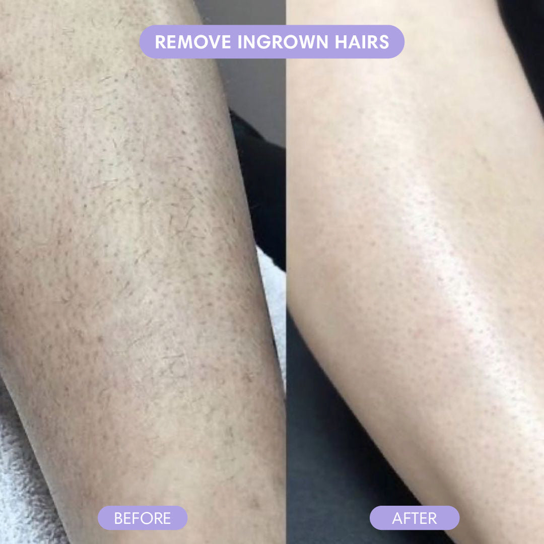 PuraPulse conversion PDP before and after proof image