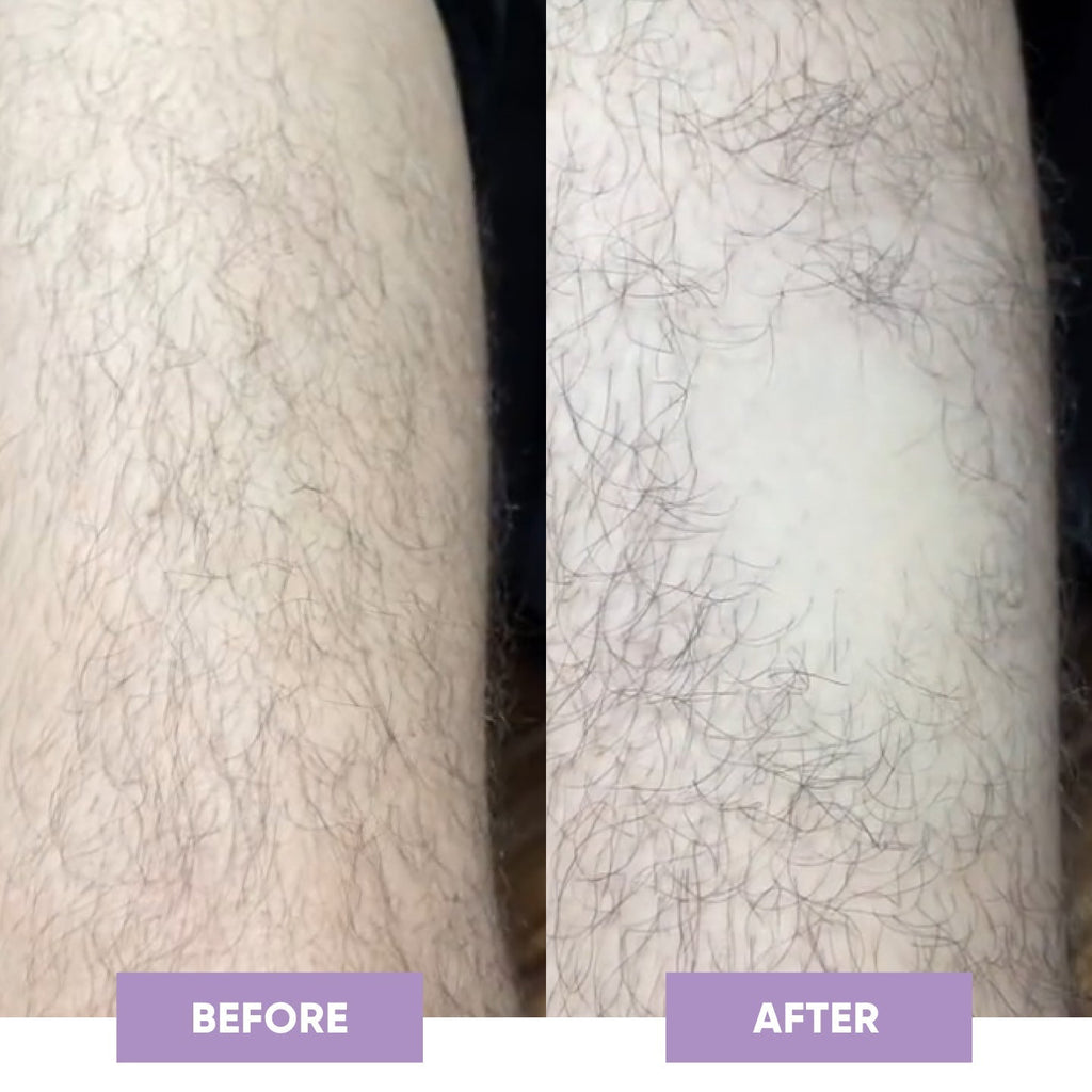 PuraPulse conversion PDP before after square image