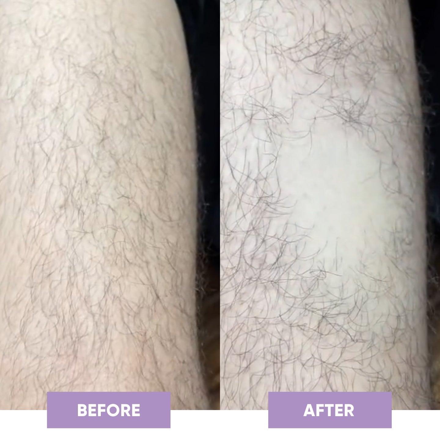 PuraPulse conversion PDP before after square image